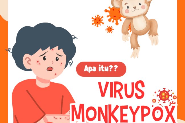 Waspada yuk,, Virus Monkey Pox sudah menjadi isu kesehatan global yang baru.