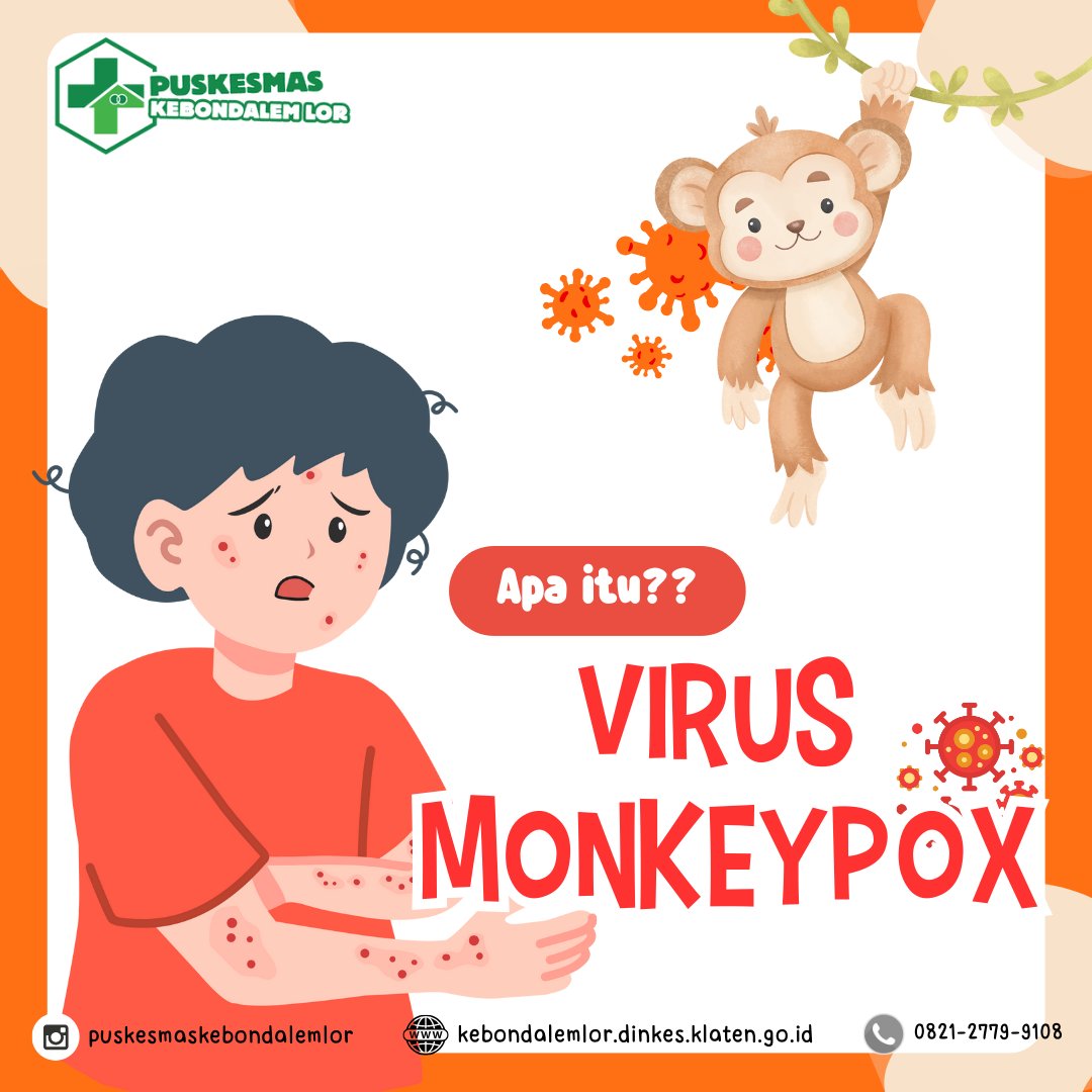 Waspada yuk,, Virus Monkey Pox sudah menjadi isu kesehatan global yang baru.